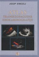 ATLAS TRANSEZOFAGUSNE EHOKARDIOGRAFIJE-0
