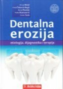 DENTALNA EROZIJA - ETIOLOGIJA, DIJAGNOSTIKA I TERAPIJA-0 DENTALNA EROZIJA - ETIOLOGIJA, DIJAGNOSTIKA I TERAPIJA-0