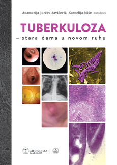 TUBERKULOZA - Stara dama u novom ruhu-0 TUBERKULOZA - Stara dama u novom ruhu-0